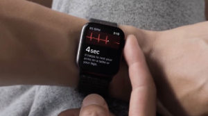 Apple watch ECG